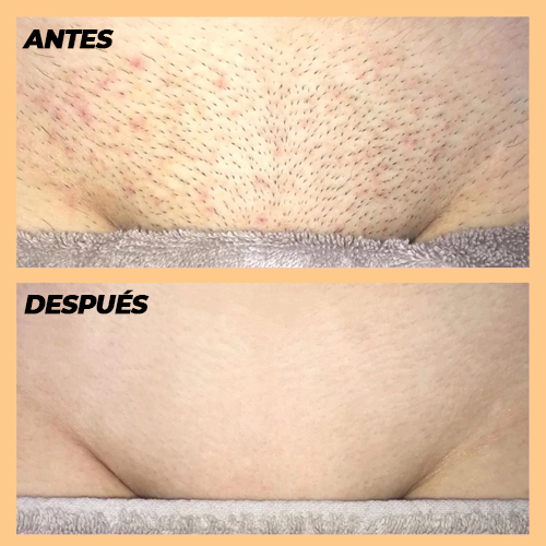 Depiladora Láser Piel Perfecta (ENTREGA 24 HORAS)