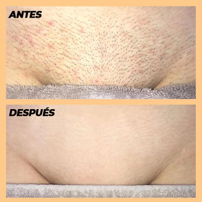 Depiladora Láser Piel Perfecta (ENTREGA 24 HORAS)